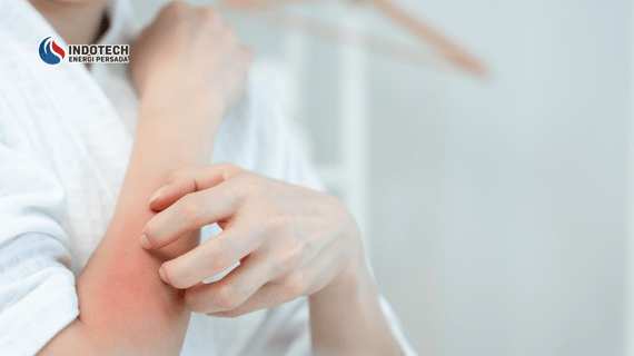 Alasan Kenapa Kulit Bisa Gatal Setelah Mandi Air Hangat