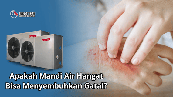 Apakah Mandi Air Hangat Bisa Menyembuhkan Gatal
